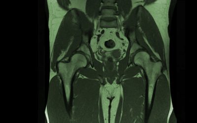 IRM Abdomen – Pelvis – Bassin – Entéro IRM – Prostate – Rectum