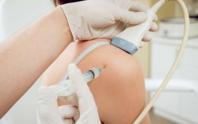 infiltration sous échographie ou radiographie