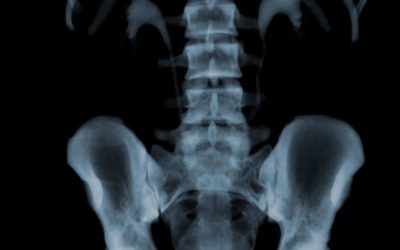 Scanner abdomen/pelvis (AP – lombaire- uroscanner)
