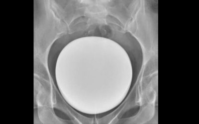 Cystographie